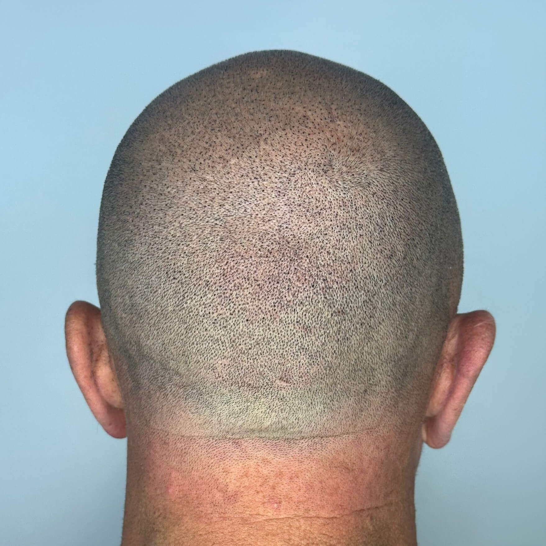 resultaat ná de hairtattoo